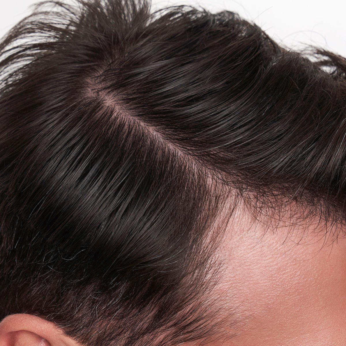 Homme — avant application des fibres Toppik